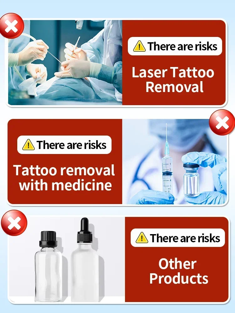 Tattoo Removal Cream – Effective for Large & Small Permanent Tattoos