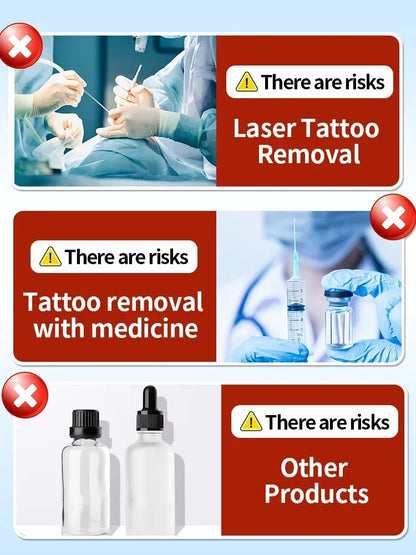 Tattoo Removal Cream – Effective for Large & Small Permanent Tattoos