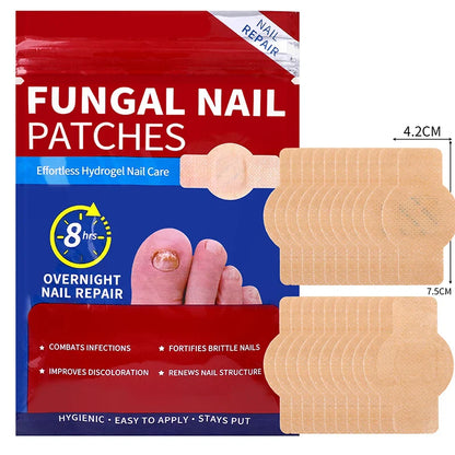 21/105pcs Waterproof Nail Fungus Repair Patches — Ingrown Nail Correction Stickers for Damaged Nail & Feet Care