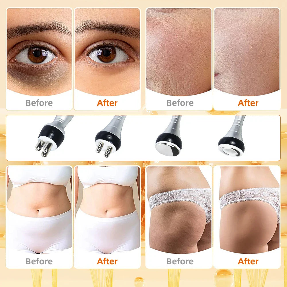 4-in-1 40K Cavitation Body Slimming Machine – Skin Tightening, Face Lifting & Vacuum Massager (Overseas Warehouse)