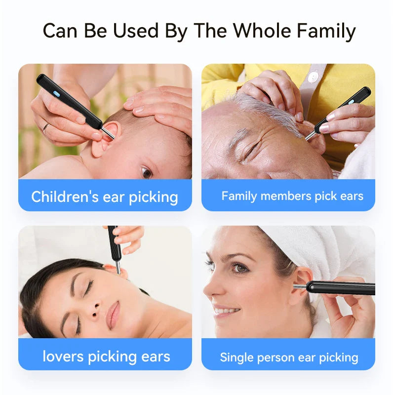 Wireless Ear Wax Cleaner with Camera – Safe Earwax Removal Endoscope with LED Light, Ear Cleaning Tool for Ear Care