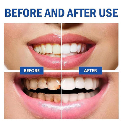 120g Hydroxyapatite Toothpaste – Gentle Mint, Whitening & Stain Removal Oral Care