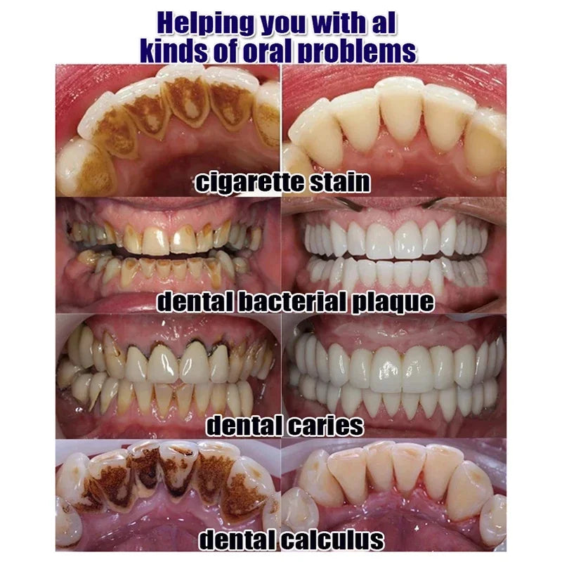 Dental Calculus Remover & Whitening Toothpaste – Fresh Breath & Periodontitis Prevention