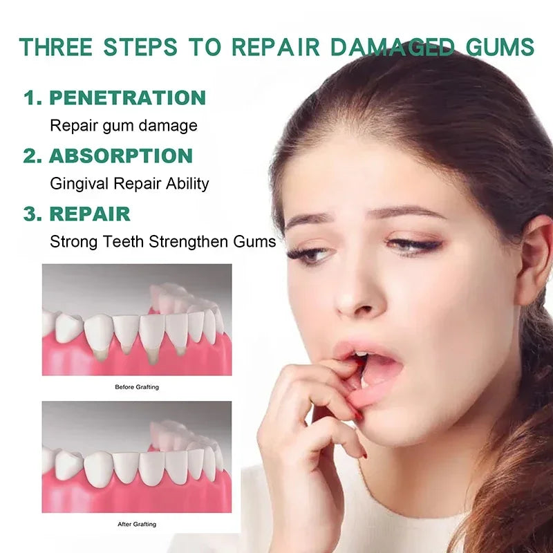 30ml Gingival Repair Drops – Fast Treatment for Cavities, Receding Gums & Gum Pain Relief