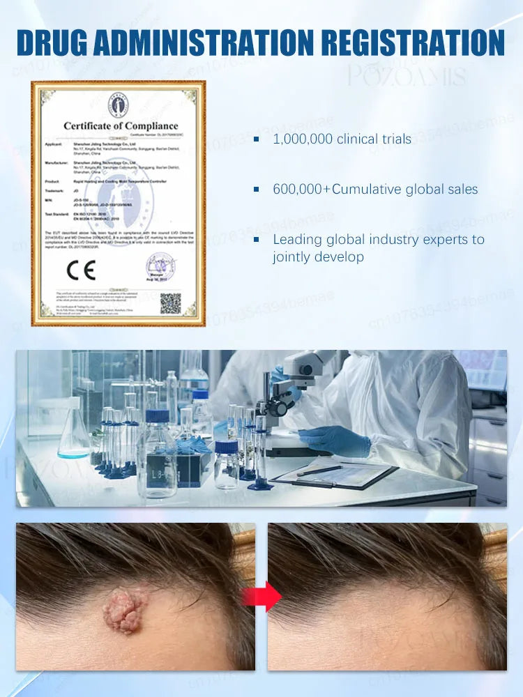 Quick Wart & Sarcoma Removal Treatment – Fast & Effective Skin Care Solution