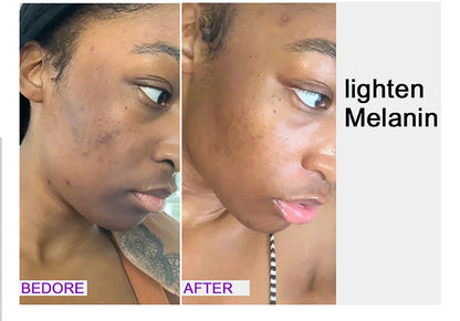AILKE Glutathione Lightening Body Lotion – Moisturizing & Hydrating for Even Skin Tone and Dark Spot Improvement