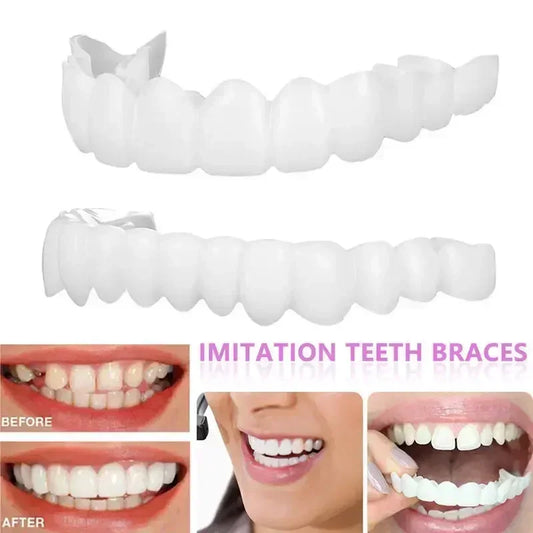 Perfect Fit Teeth Whitening Fake Tooth Cover – Snap-On Silicone Smile Veneers for Upper Teeth, Reusable Cosmetic Tool
