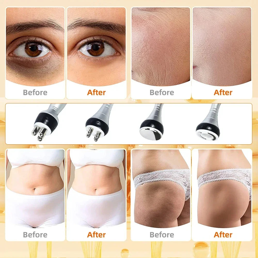 40K 3-in-1/4-in-1 Cavitation Body Slimming Machine – Facial Massager, Skin Tightening, Face Lifting & Vacuum Suction Beauty Device