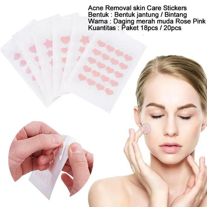 72pcs Invisible Anti-Acne Pimple Patches – Hydrocolloid Waterproof Spot & Mark Repair Stickers