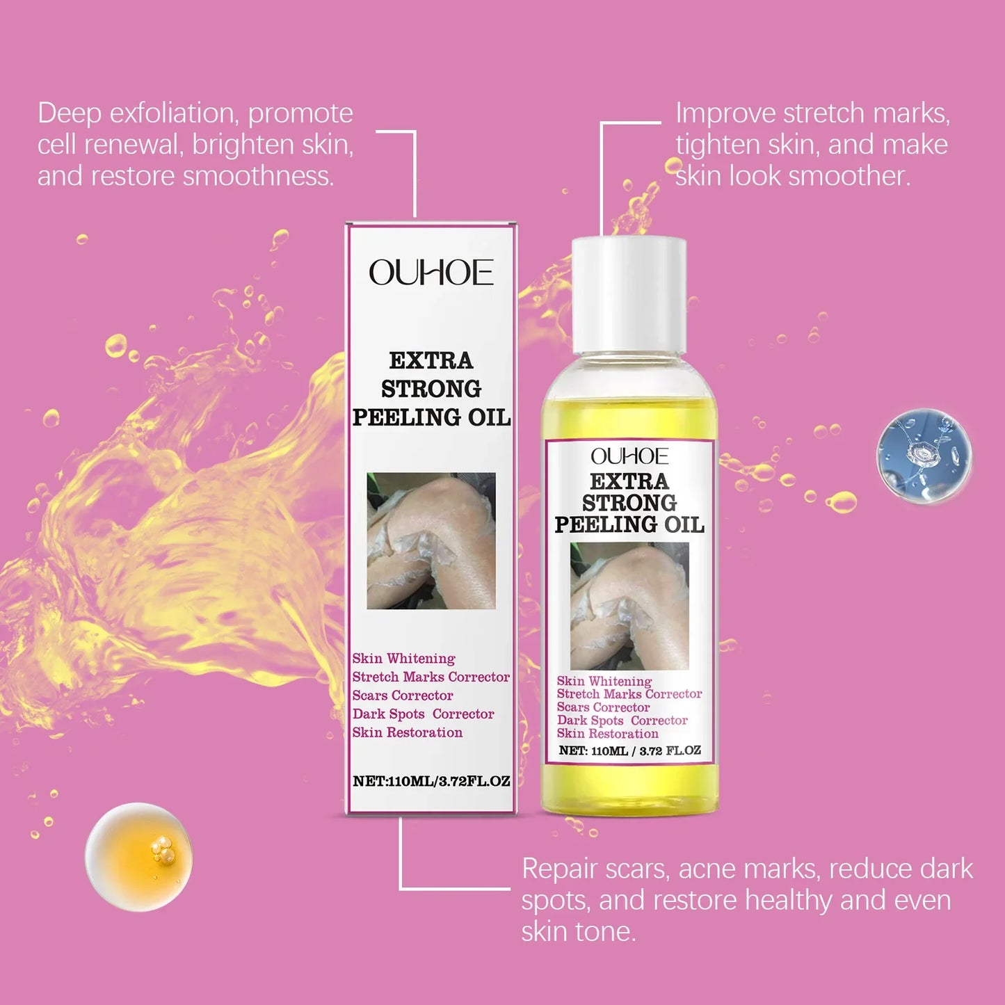 30/110ml Super Strength Body Peeling Oil — Brightening, Moisturizing & Exfoliating Skin Care Oil