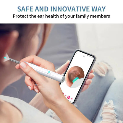 Smart Visual Ear Cleaner 1296P with Camera – USB-C Rechargeable Ear Wax Removal Tool, WiFi, 6 LED Lights