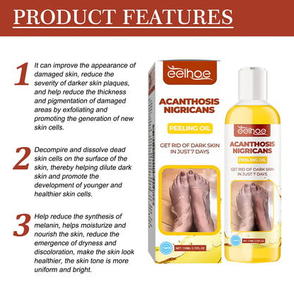 EELHOE Peeling Oil for Dark Skin — 110ml Exfoliator to Remove Dead Skin & Brighten Arms, Elbows, Knees, Legs