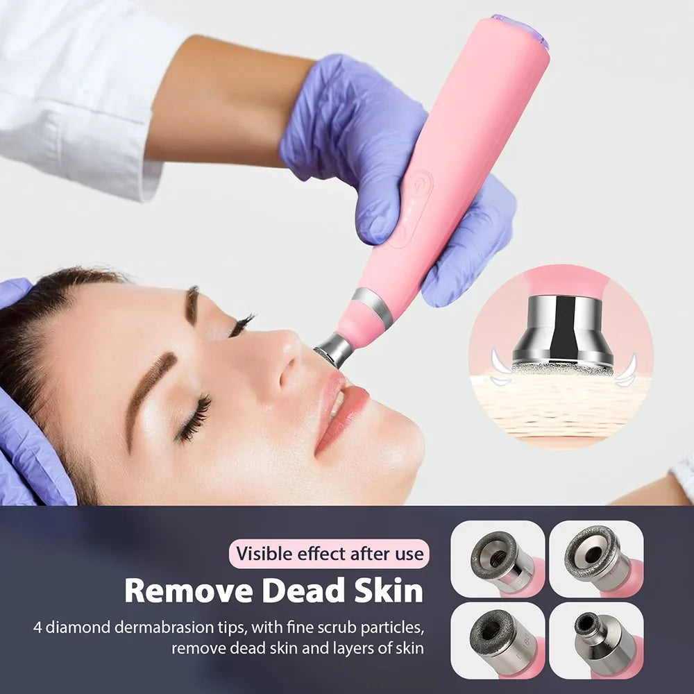 Foreverlily Portable Diamond Peeling Machine – Microdermabrasion Facial Cleaner & Blackhead Remover Vacuum Device