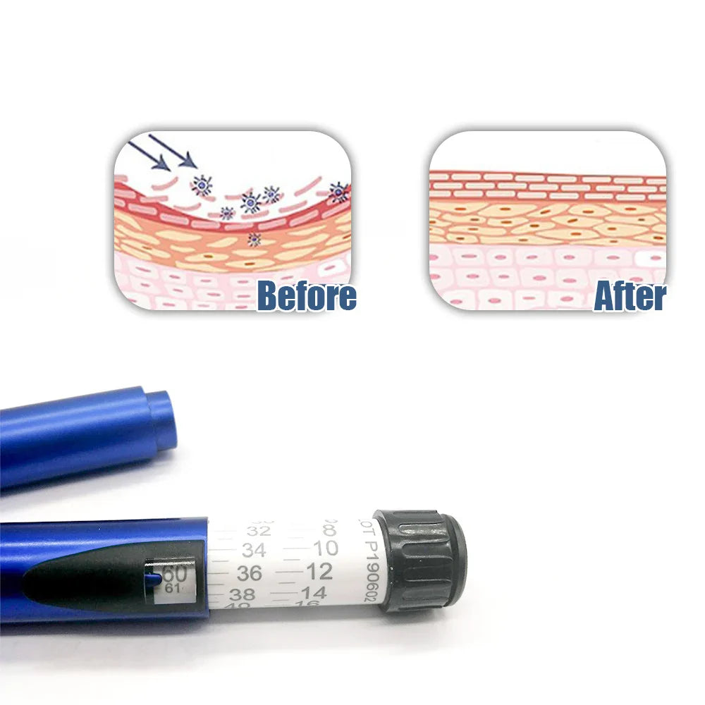 Magic Pen Wrinkle Care – Facial Wrinkle Remover with Three-Line Lifting & Tear Trough Filling Sterile Cartridge