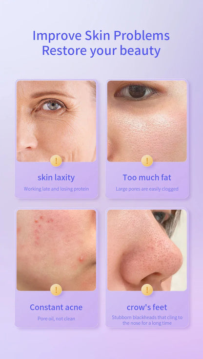 Hot Cold Electroporation No Needle Mesotherapy Machine – Anti-Aging RF Skin Cooling & Face Lifting Facial Equipment