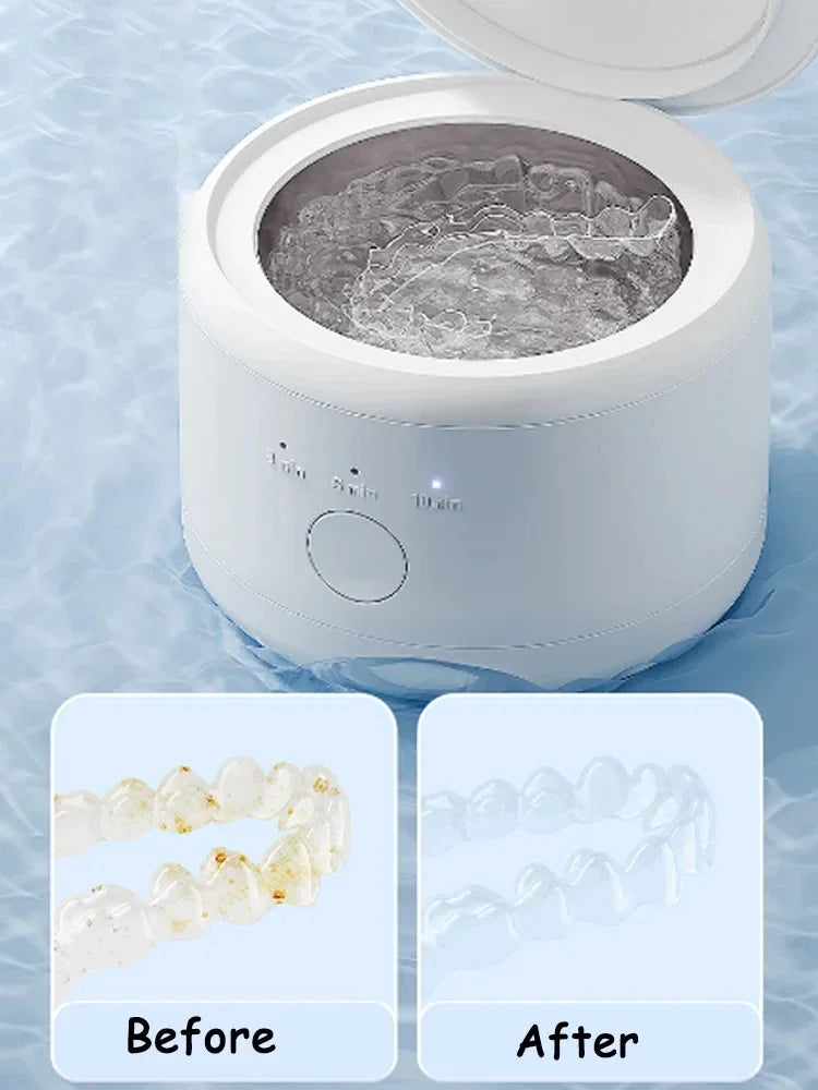Xiaomi MIJIA Electric Braces & Retainer Cleaning Box – Multifunctional Denture & Jewelry Cleaner, Orthodontic Care Machine