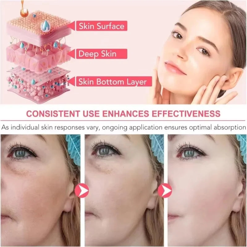 100g Collagen Jelly Face Cream – Nourishing Moisturizer, Pore Shrinking & Comedone Removal, Korean Skin Care