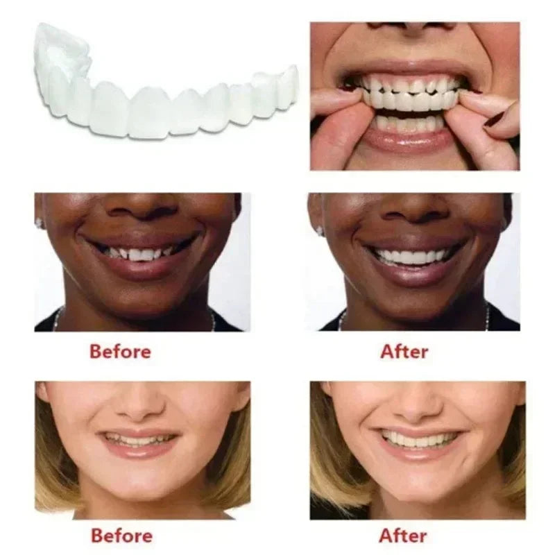 Perfect Fit Teeth Whitening Fake Tooth Cover – Snap-On Silicone Smile Veneers for Upper Teeth, Reusable Cosmetic Tool
