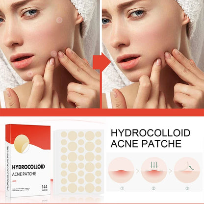 144PCS Acne Pimple Patch Set – Invisible Hydrocolloid Spot Stickers for Face Care & Healing (Men & Women)