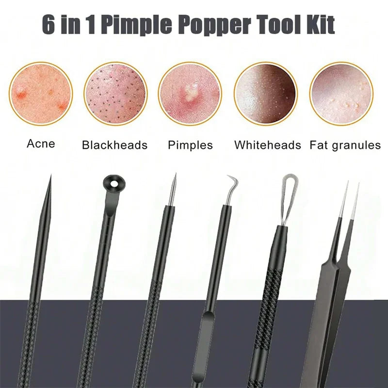 4/6PCS Face Cleaning Kit – Pimple, Blackhead & Whitehead Remover Tools for Acne and Comedone Care