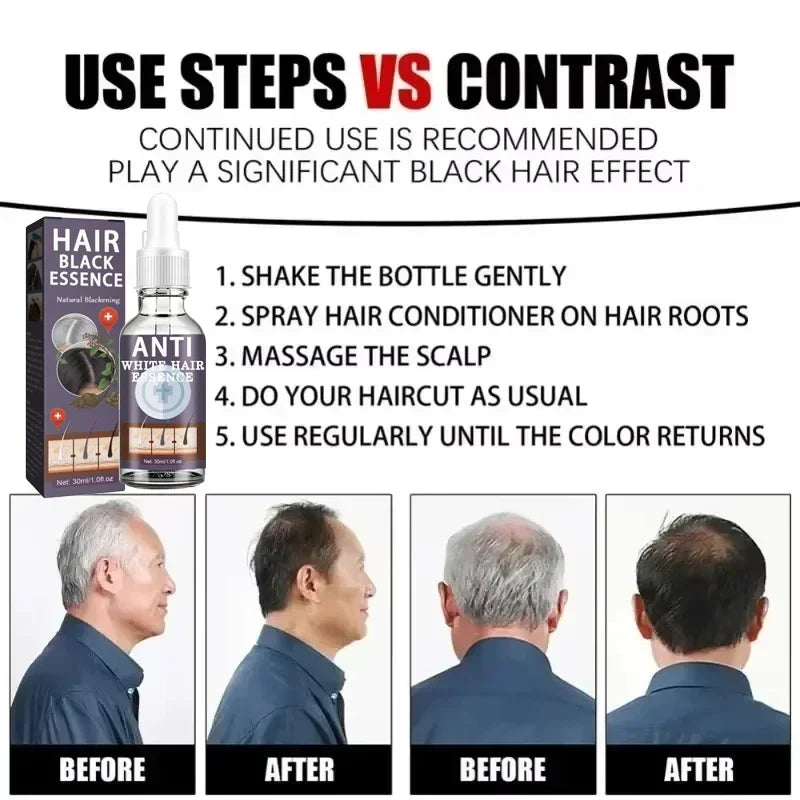 White Hair Remover – Restore Natural Hair Color in 7 Days, Gray Hair Treatment Solution