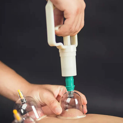 12/24-Cup Chinese Vacuum Cupping Therapy Set – Pull-Out Suction Massager for Pain Relief & Muscle Relaxation