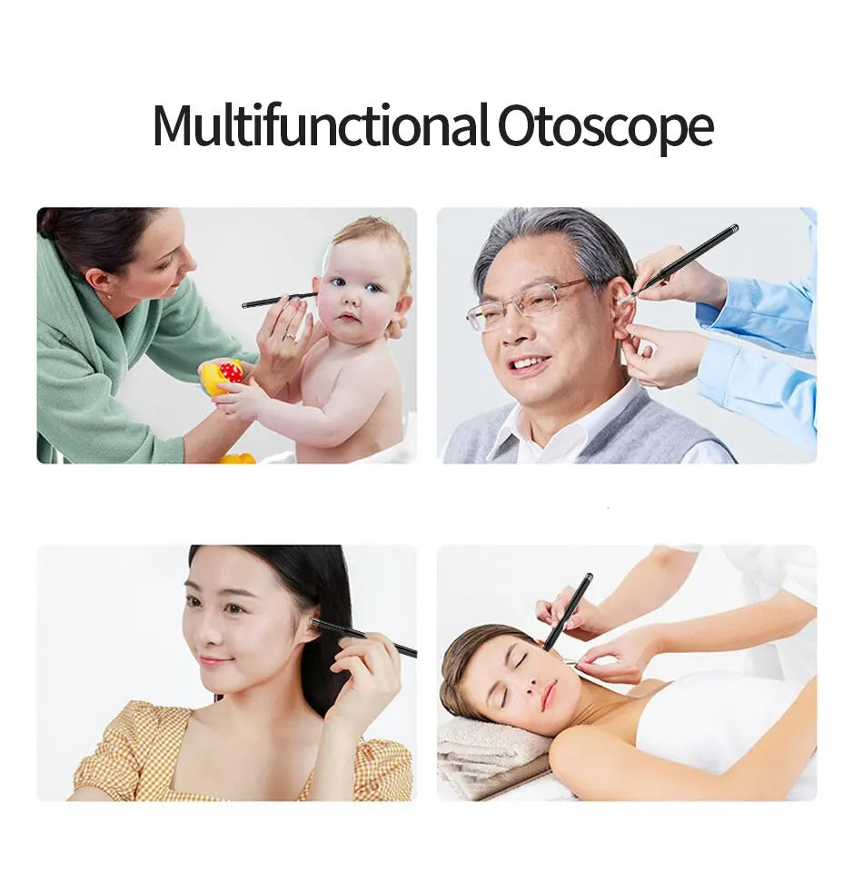 3-in-1 Smart Ear Cleaner Endoscope with Earwax Remover & Otoscope - 5.5mm, Android/PC Type-C Compatibility