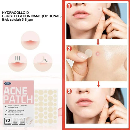 72pcs Invisible Anti-Acne Pimple Patches – Hydrocolloid Waterproof Spot & Mark Repair Stickers
