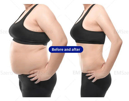 EMSzero Mini Body Sculpting Machine | NEO RF Electromagnetic Muscle Stimulation & Fat Removal 2025