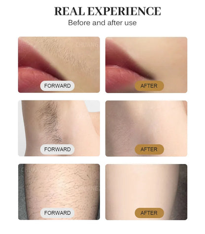 2025 3000W Alexandrite Ice Platinum Diode Laser Epilator - Professional Permanent Hair Remover for Women