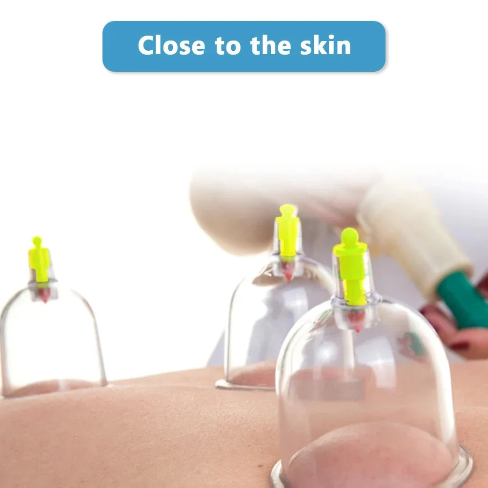12/20/24 Cans Vacuum Acupuncture Cupping Set – Anti-Cellulite & Physiotherapy Suction Cup Massage Therapy