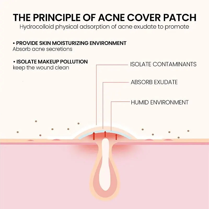 Acne Patch for Facial Skin Care - Fade Blemishes & Pimple Marks - Cover & Repair Acne Blemishes