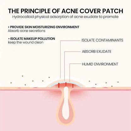 Acne Patch for Facial Skin Care - Fade Blemishes & Pimple Marks - Cover & Repair Acne Blemishes