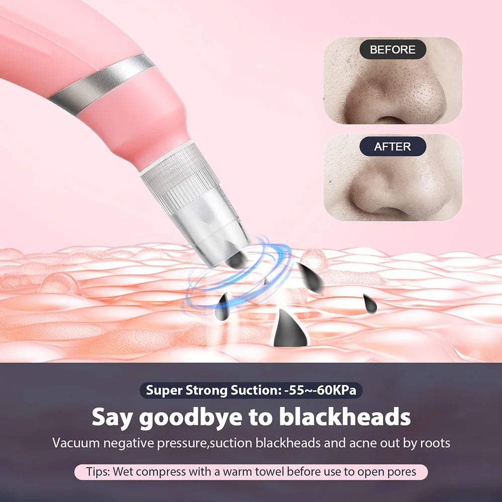 Foreverlily Portable Diamond Peeling Machine – Microdermabrasion Facial Cleaner & Blackhead Remover Vacuum Device