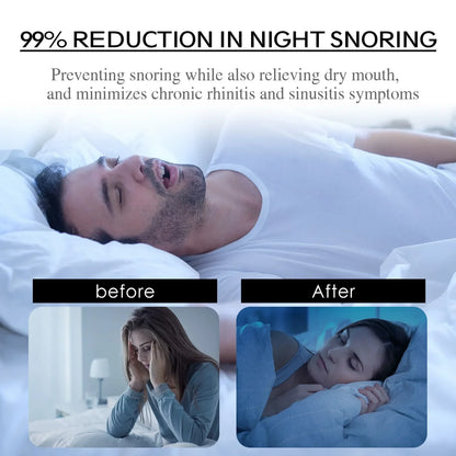 EELHOE Anti-Snoring Patch – Sleep Improvement Sticker for Better Breathing, Portable Mouth Orthosis Tape to Stop Snoring