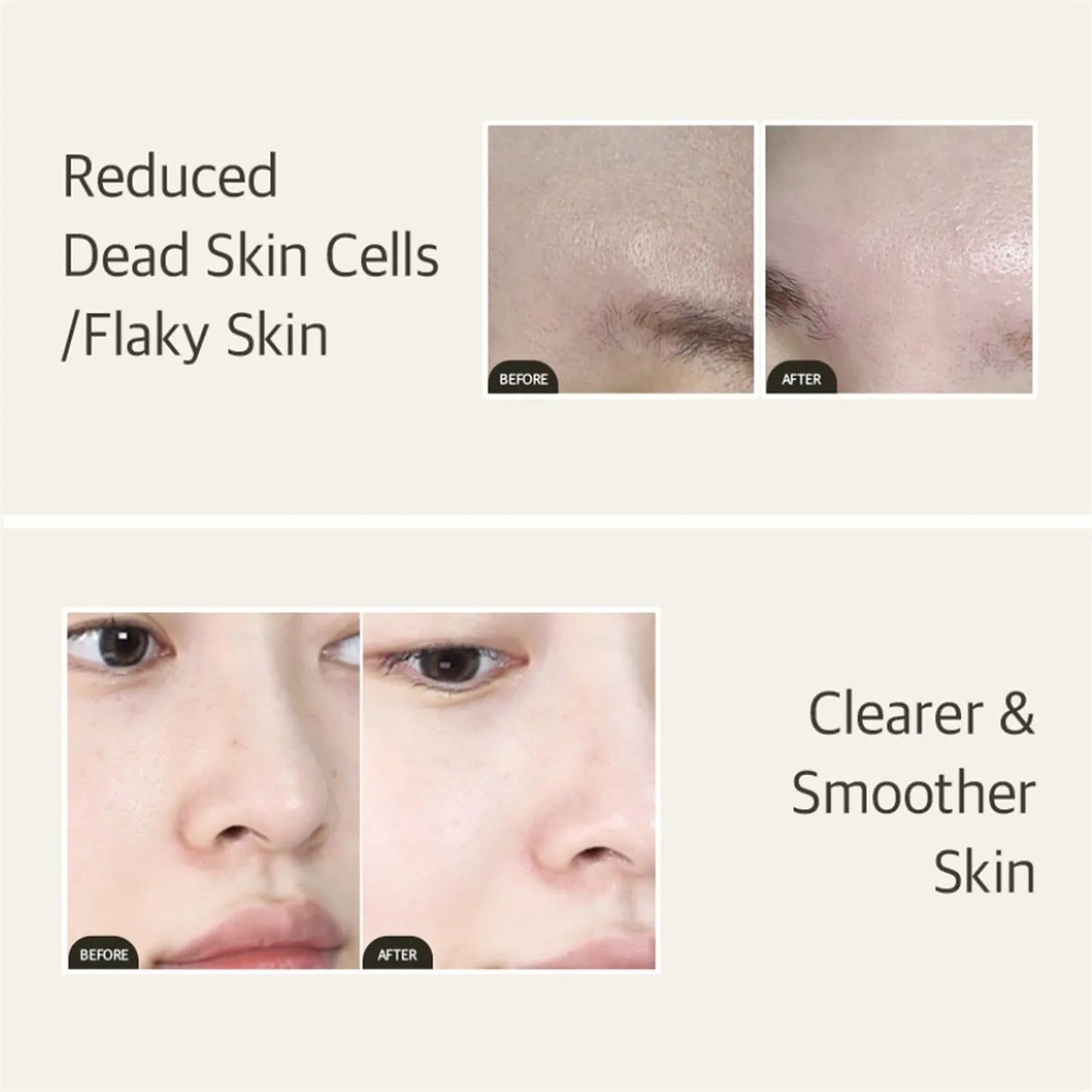 50ml Mixsoon Bean Essence – Vegan Snail Exfoliating & Hydrating Korean Skin Care for Glass Skin