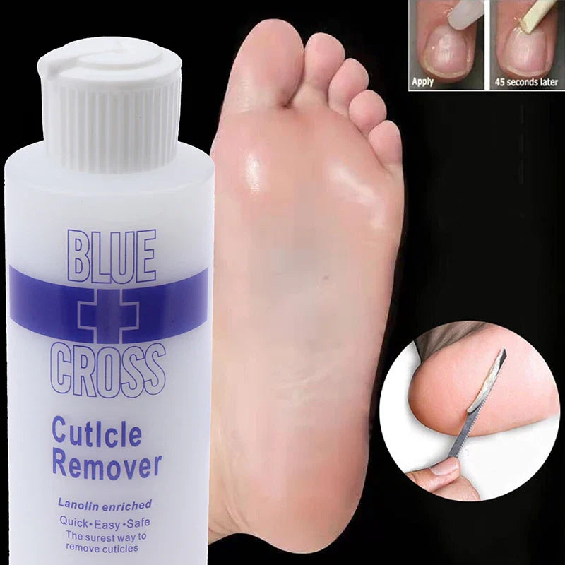30ml/177ml Foot Cuticle Remover & Dead Skin Exfoliator – Callus Softener Foot Mask for Pedicure Nail Care