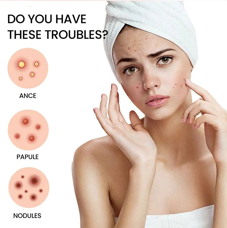 Acne Repair Patch - Facial Skin Care for Blemish & Pimple Marks, Acne Treatment & Pimple Repair Cover