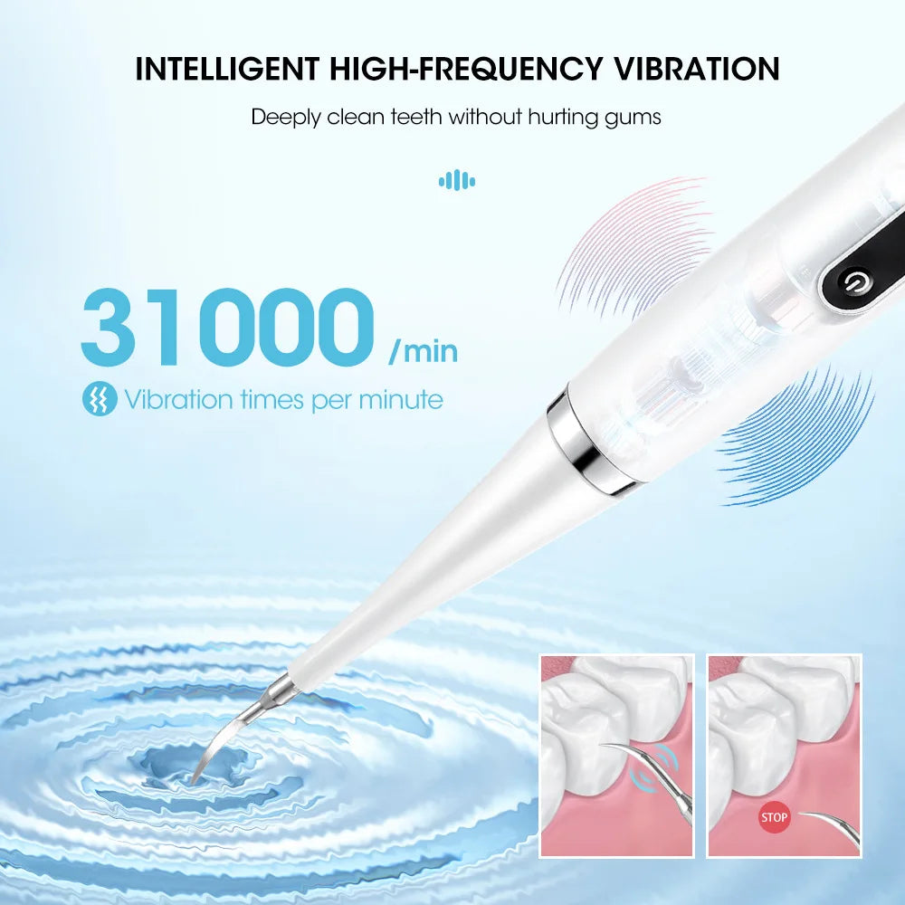 Electric Tooth Whitening Brush – Sonic Teeth Cleaner, Dental Scaler, Plaque & Calculus Remover Kit