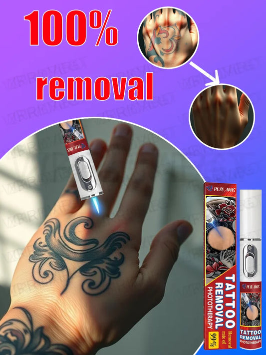 Laser Tattoo Removal Pen – Effective Portable Tattoo Eraser