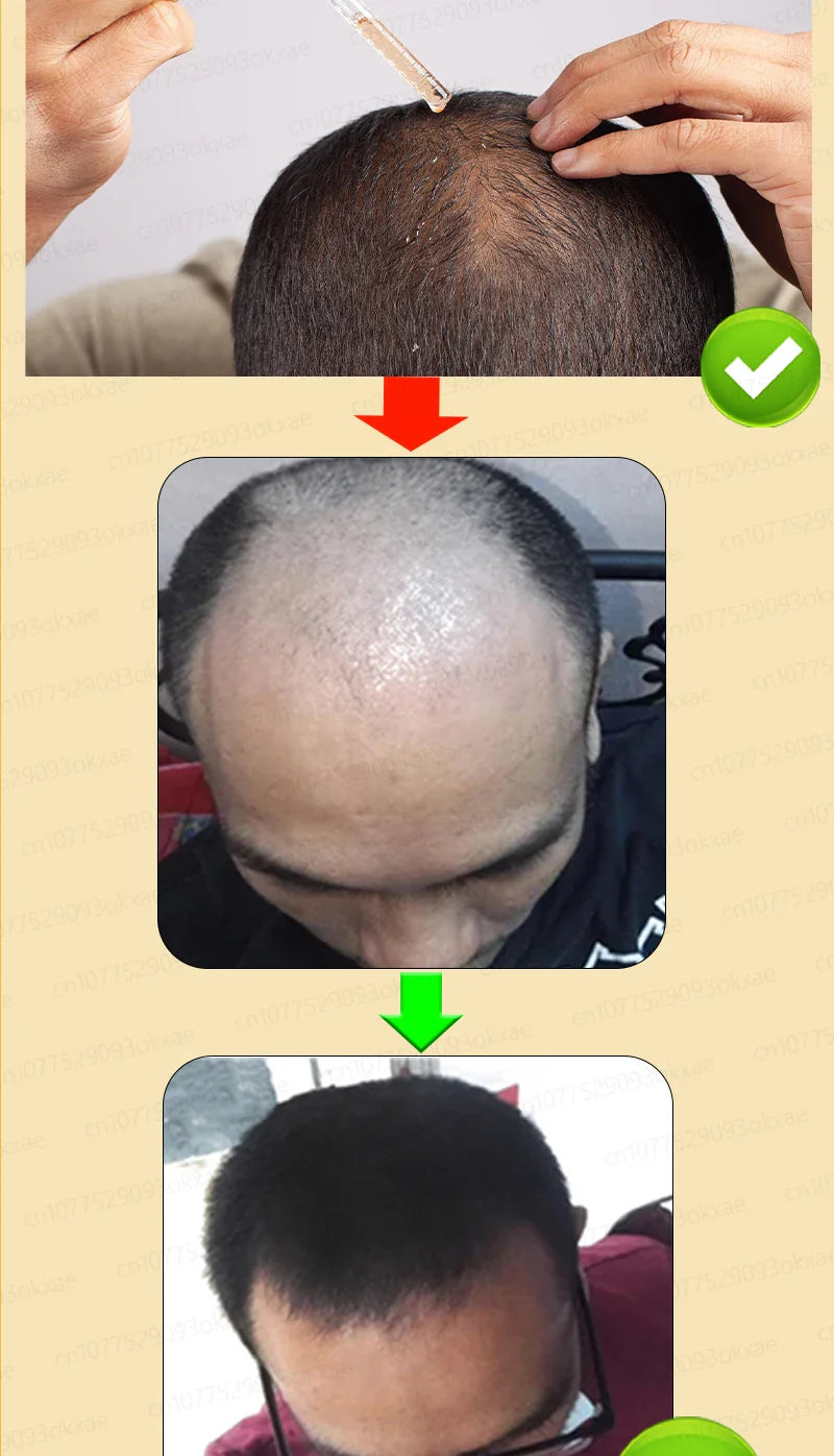 Rapid Hair Growth Serum – Beard, Chest & Body Hair Enhancer for Fuller, Thicker Growth