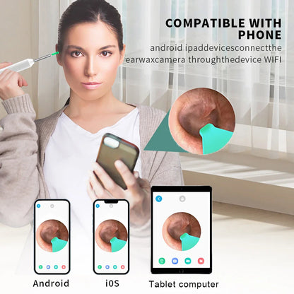 Earwax Remover Cleaning Tool – Ear Endoscope with Mini Camera, USB-C Charging Earpick Health Care Set for iPhone & Android, Best Gift
