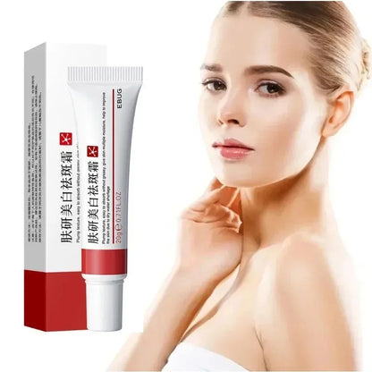 Niacinamide Whitening Freckle Cream – Anti Dark Spot, Melasma & Pigmentation Removal Anti-Aging Skin Brightening Cream (1/3/5pcs)