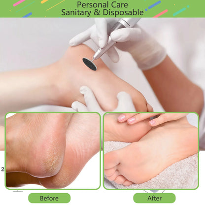 100-Piece Pedicure Sanding Paper Set — Replaceable Foot Callus Removal Discs with 1 Pedicure Disk Pad
