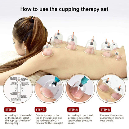 12/24-Cup Chinese Vacuum Cupping Therapy Set – Pull-Out Suction Massager for Pain Relief & Muscle Relaxation
