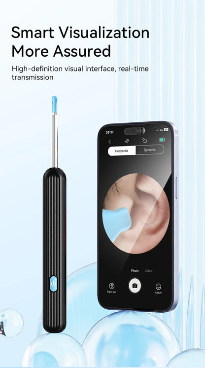 Wireless Ear Wax Cleaner with Camera – Safe Earwax Removal Endoscope with LED Light, Ear Cleaning Tool for Ear Care