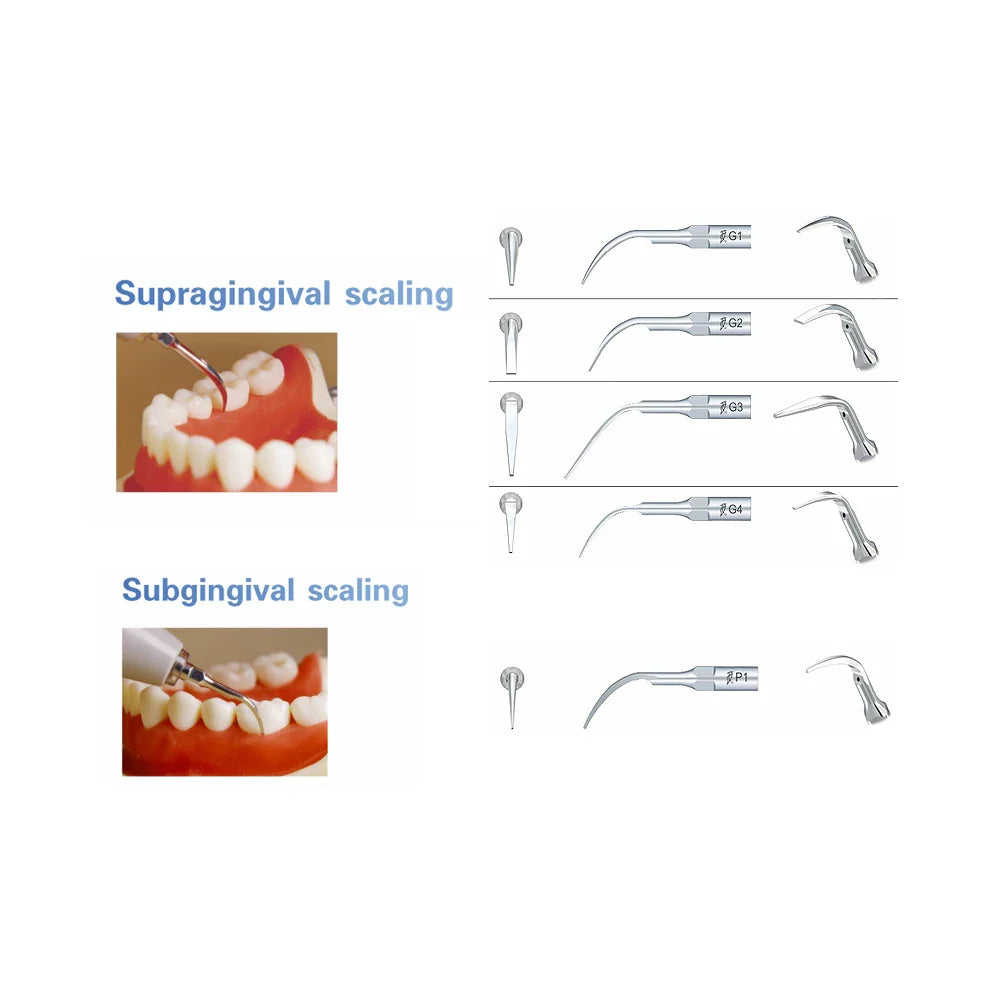 5 Work Tips Woodpecker G1, G2, G3, G4, P1 for Dental Cleaning – Woodpecker Dental Tools