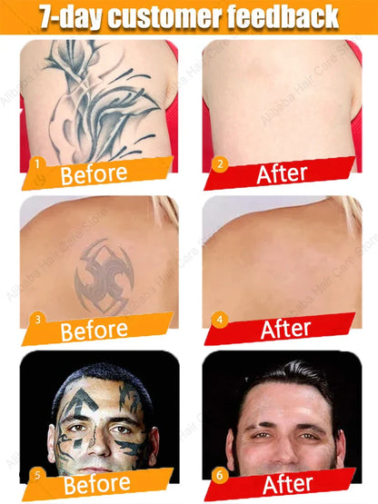 Tattoo Removal Spray — Fast-Acting Formula Removes Tattoos in 7 Days
