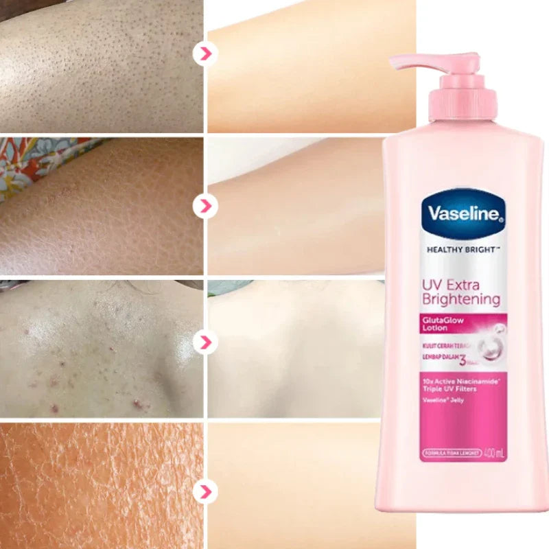 Whitening & Moisturizing Vaseline Body Lotion – Niacinamide Brightening Skin Lotion, 100ml/400ml Options