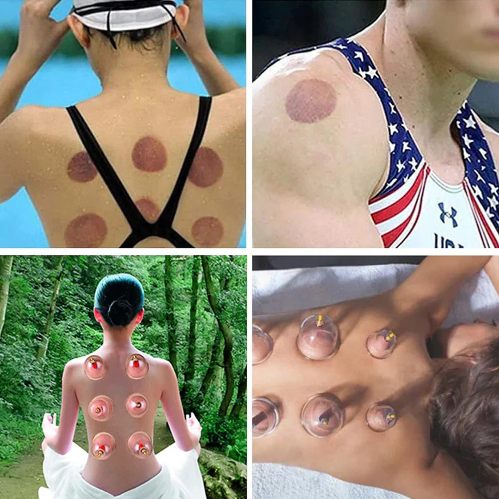32-Can Thickened Household Vacuum Cupping Machine — Non-Glass Health Massage Tool